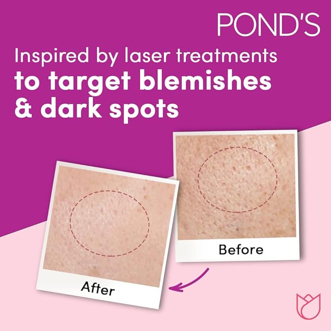 Pond's Flawless Radiance Night Cream, with Niacinamide Even-tone Glow Fades Dark Spots and Blemishes, 50g